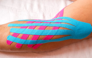 ניקוז לימפטי עם טייפינג