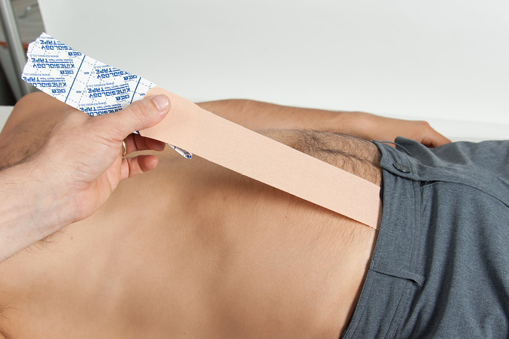 קינזיוטייפינג לשרירי הבטן